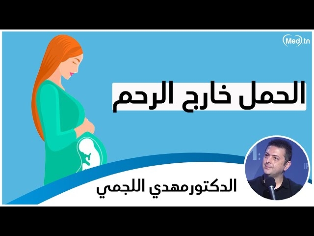 Video الحمل خارج الرحم الدكتور