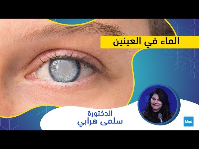 Video الماء في العينين