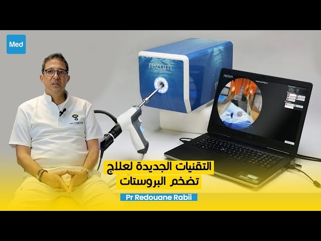 Video التقنيات الجديدة لعلاج تضخم البروستات