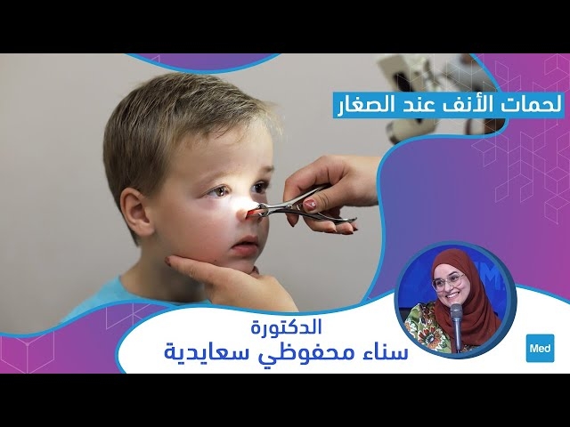 Video     لحمات الأنف عند الصغار 