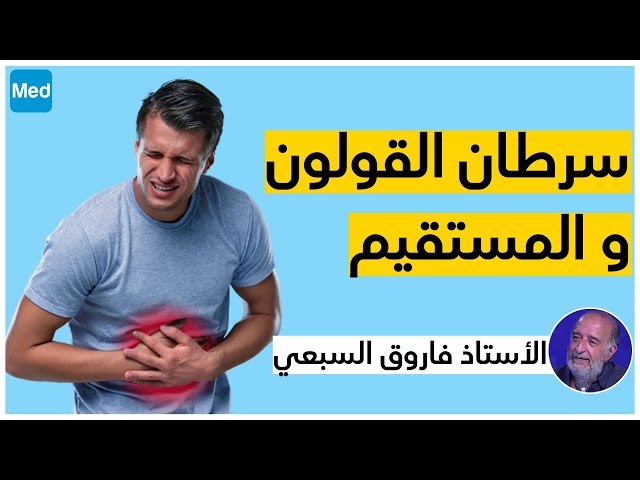 Video أورام الأمعاء الغليظة و مضاعفاتها