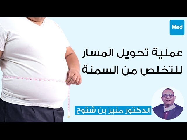 Video عملية تحويل المسار للتخلص من السمنة 