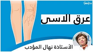 Video Nerf Sciatique 