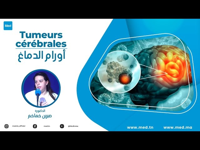 فيديو أورام الدماغ 