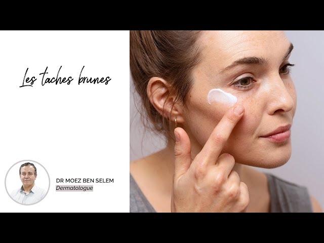 Video Dr Moez Ben Salem - Les taches brunes