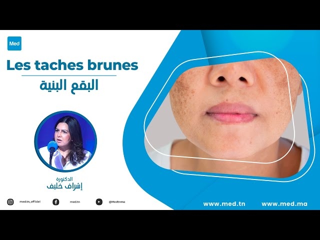 Video Les taches brunes