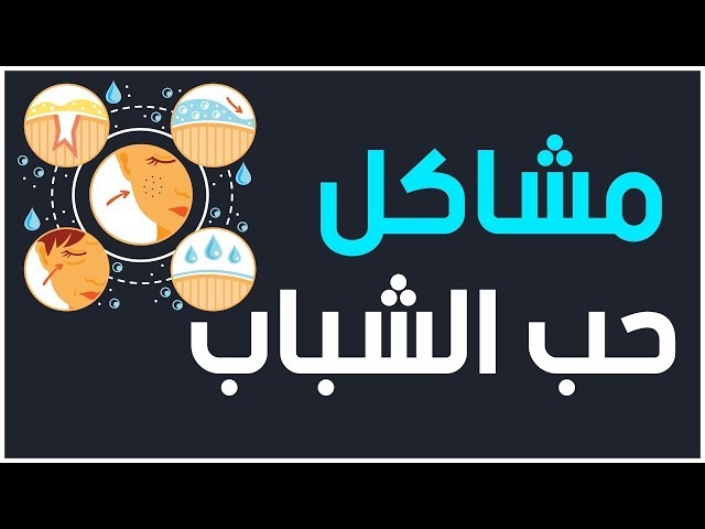 Video Acné : Causes, symptômes et traitement