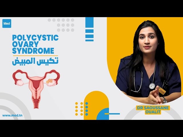 Video Polycystic ovary syndrome