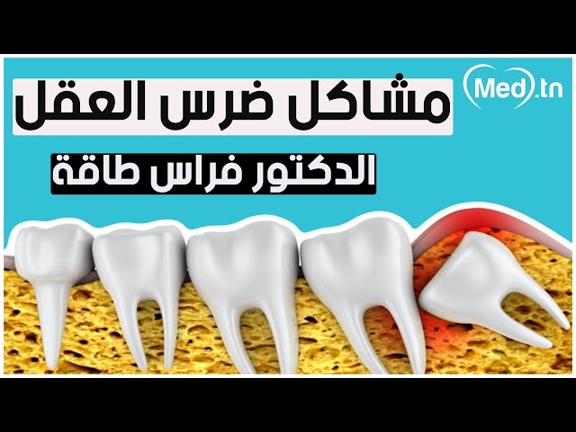 Video dent de sagesse