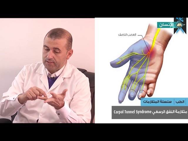 Video متلازمة النفق الرسغي