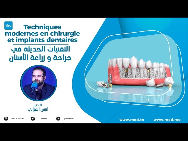 Video Techniques modernes en chirurgie et implants dentaires 