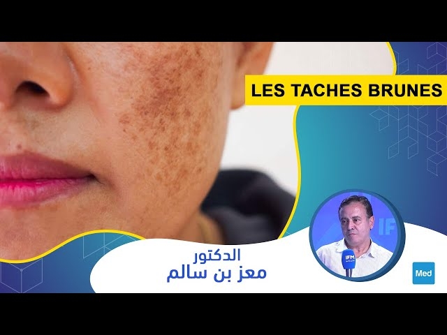 Video Les taches brunes