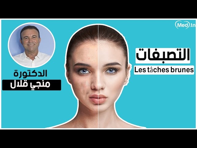 Video Les tâches brunes 