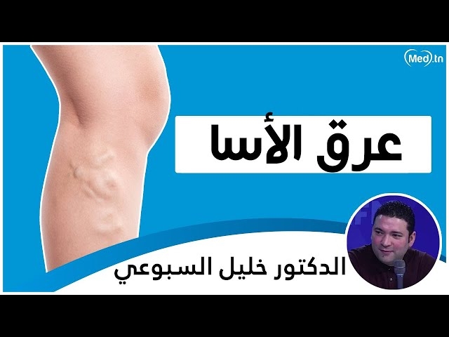 Video عرق الأسا
