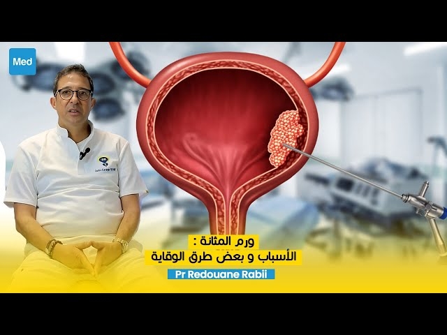 Video ورم المثانة : الأسباب و بعض طرق الوقاية