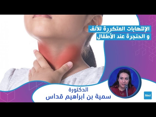 Video الإلتهابات المتكررة للأنف و الحنجرة عن الأطفال