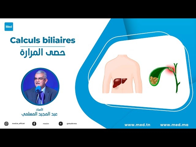 Video Calculs biliaires
