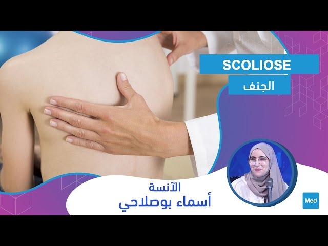 فيديو الجنف