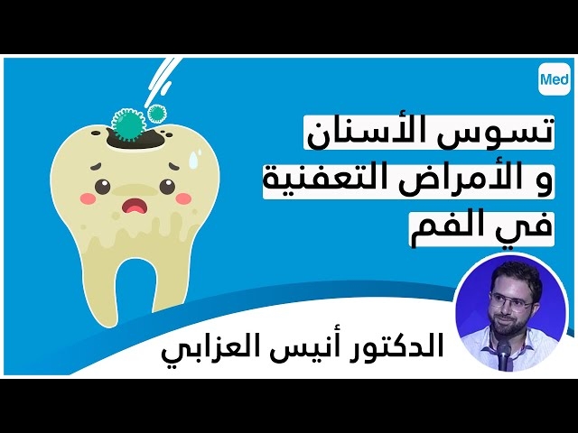 Video الأمراض التّعفنيّة للفم