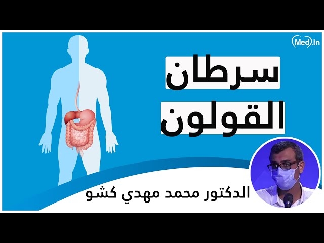 Video سرطان القولون