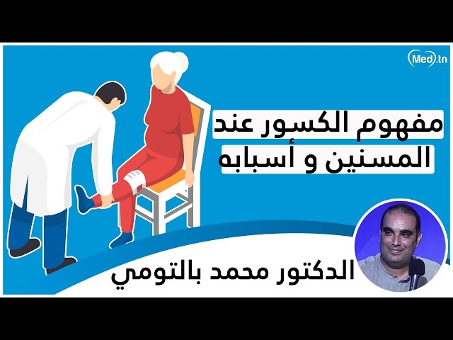 Video قصور الجزء العلوي عظم الفخذ