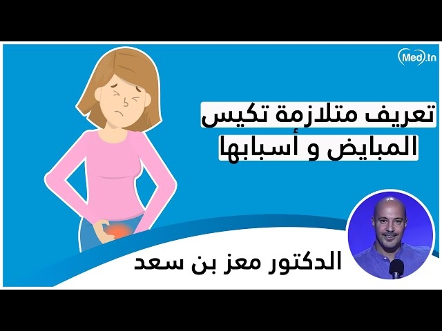 Video SOPK et ses causes