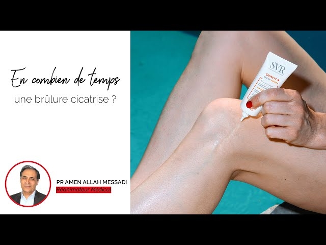 Video en combien de temps une brûlure cicatrise ?