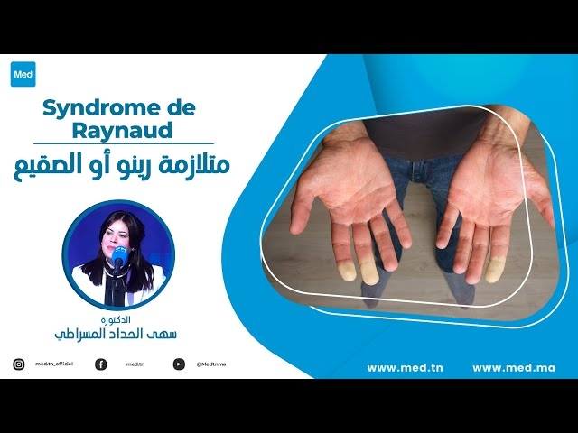 Video Syndrome de Raynaud