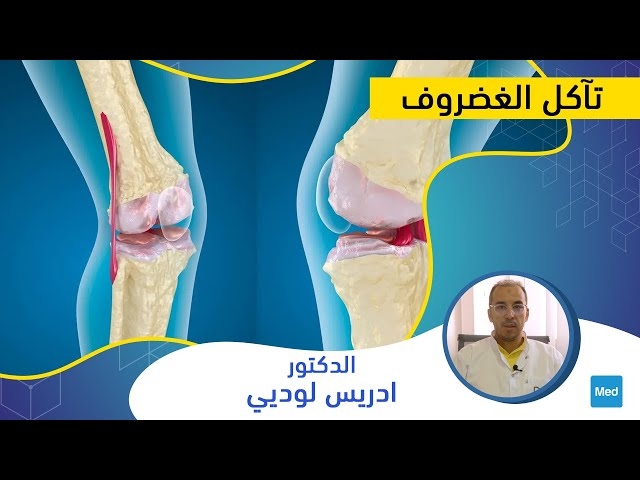 Video ﺗﺂﻛﻞ ﺍﻟﻐﻀﺮﻭف