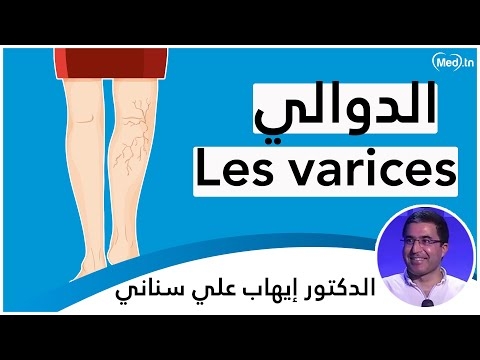 Video Les Varices 