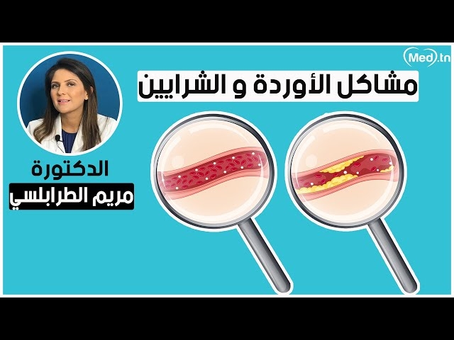 Video Problèmes vineux et artériels 