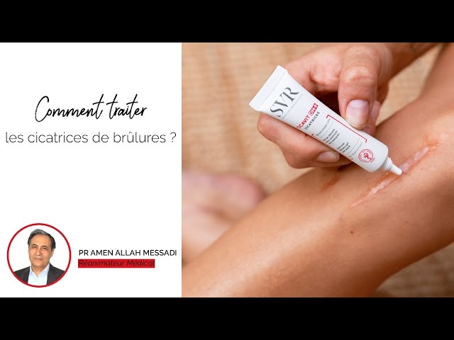 Video Comment traiter les cicatrices de brûlures ?