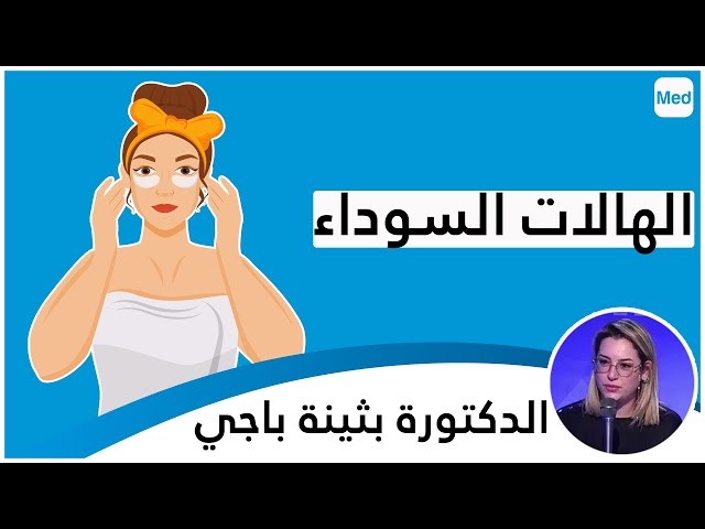 Video les cernes