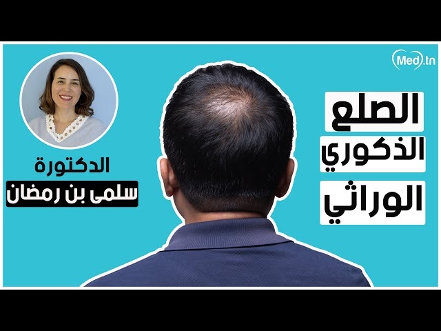 Video Alopécie héréditaire 