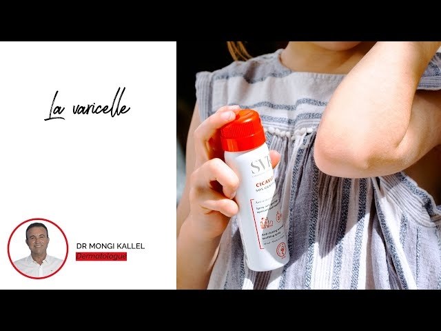 Video La Varicelle : Symptômes, signes et traitement