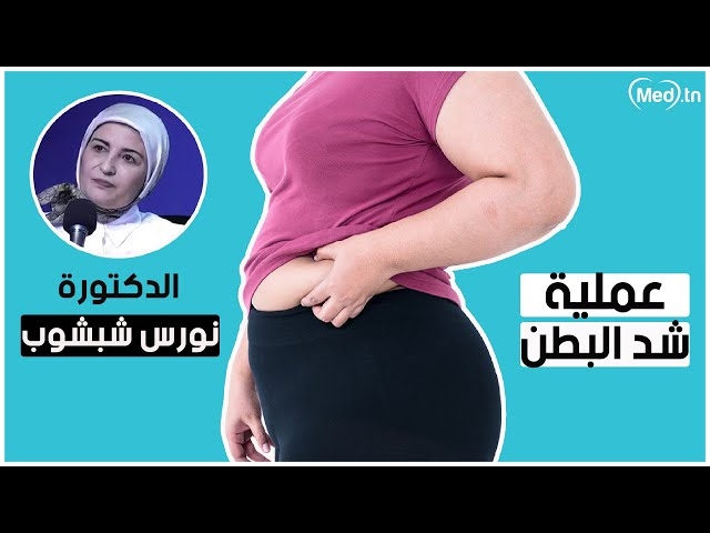 Video abdominoplasty