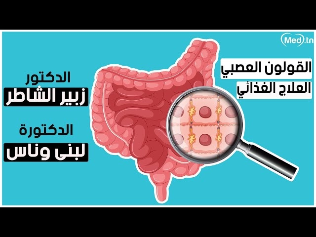 Video colon irritable 