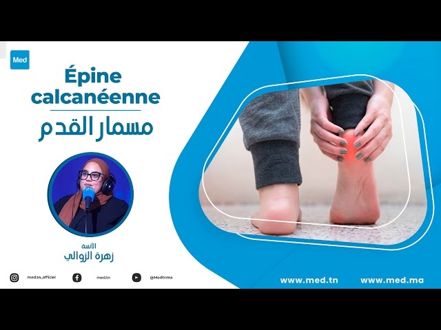 Video Épine calcanéenne