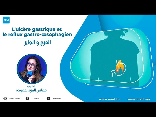 Video L'ulcère gastrique et le reflux gastro-œsophagien
