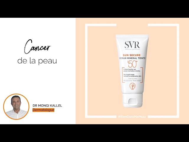 Video Cancer de la peau