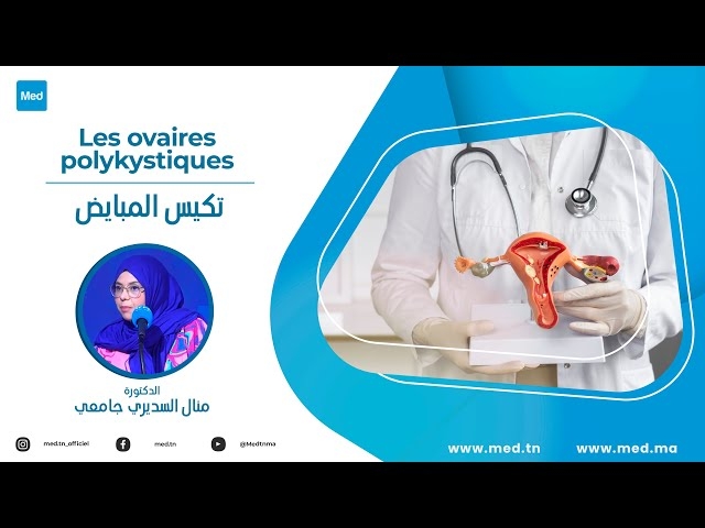 فيديو تكيس المبايض