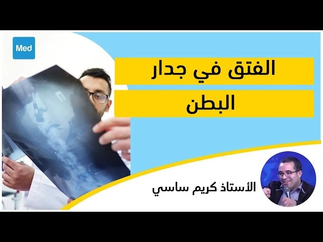 Video الفتق فيه أنواع العادية و الخطيرة و هاذي علاماته