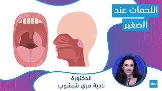 Video اللحمات عند الصغير