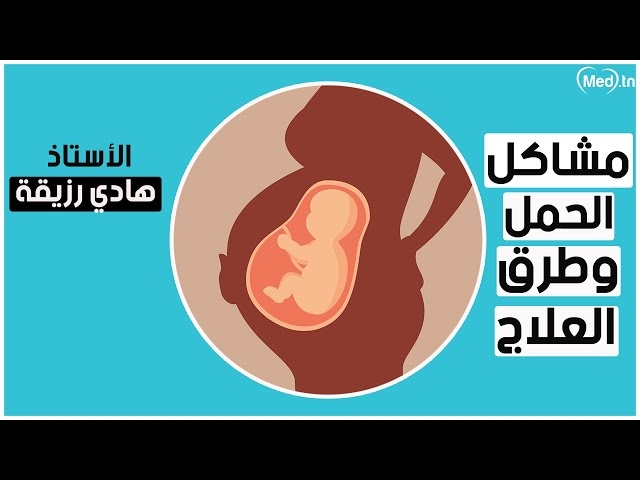Video مشاكل  الحمل وطرق العلاج 