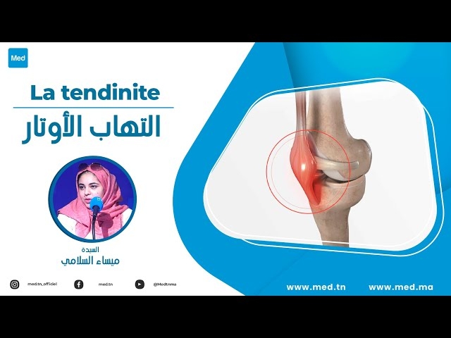 Video La tendinite