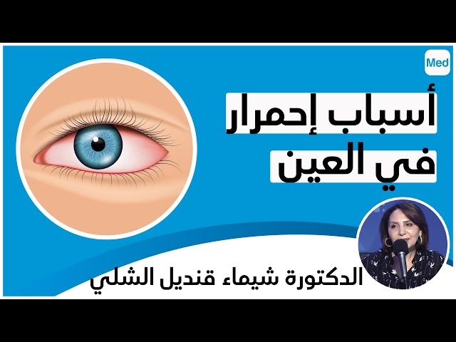فيديو الإحمرار في العين 