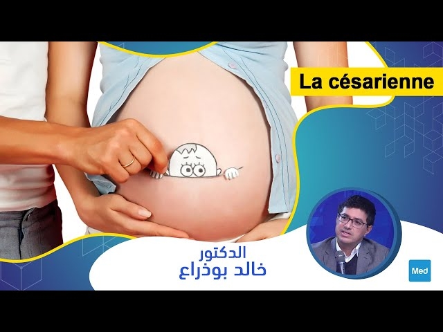 Video La césarienne
