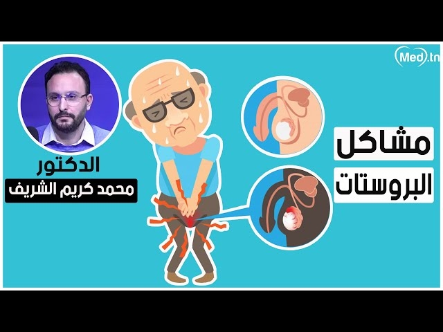 Video le prostate 