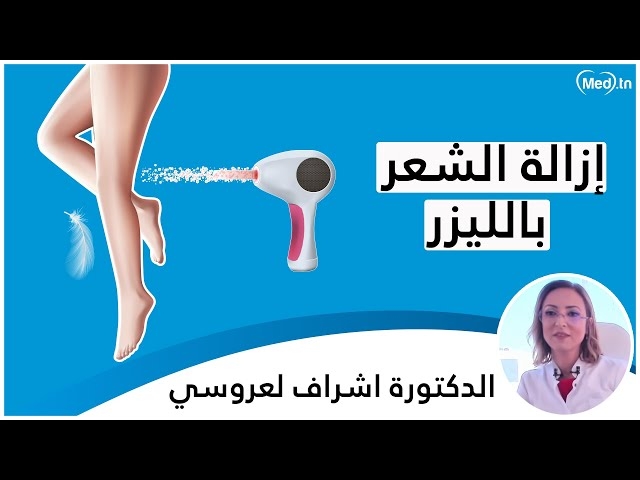 فيديو Laser épilatoire 
