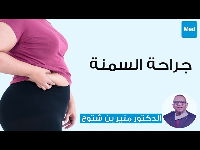 Video جراحة السمنة 